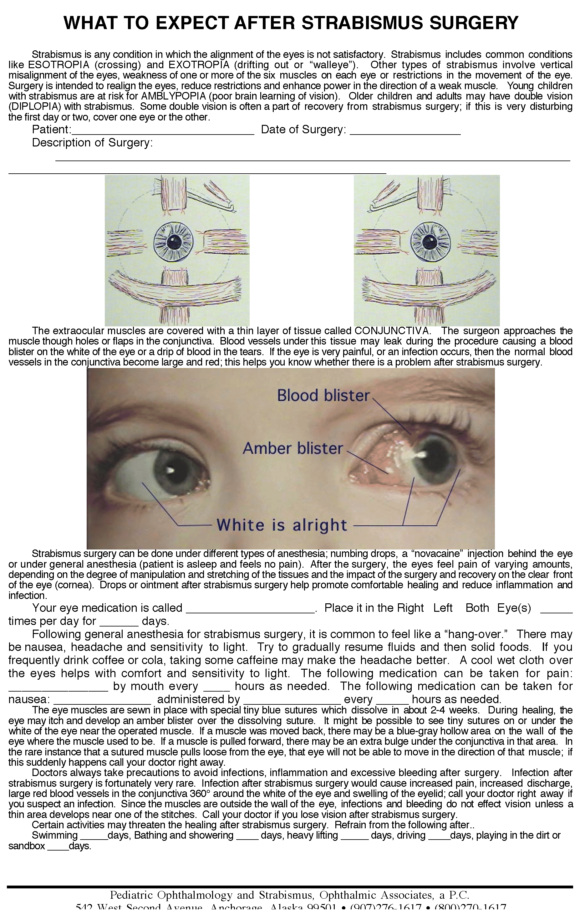 Strabismus Post Op